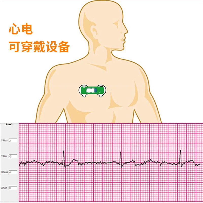BMD101 ECG Electrocardiogram S - Ecg Patch Monitor บทวิจารณ์และราคา
